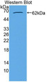 Western Blot; Sample: Recombinant protein.