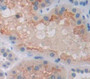 Epithelial Stromal Interaction 1, Breast (Epsti1) Polyclonal Antibody, Cat#CAU22324