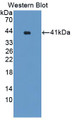 Western Blot; Sample: Recombinant protein.