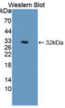 Western Blot; Sample: Recombinant protein.