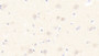 DAB staining on IHC-P; Samples: Human Cerebrum Tissue; Primary Ab: 20μg/ml Rabbit Anti-Human HSPF2 Antibody Second Ab: 2µg/mL HRP-Linked Caprine Anti-Rabbit IgG Polyclonal Antibody