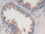 DAB staining on fromalin fixed paraffin-embedded Stomach tissue)
