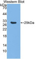 Western Blot; Sample: Recombinant protein.