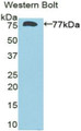 Western Blot; Sample: Recombinant protein.