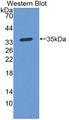 Western Blot; Sample: Recombinant protein.