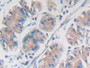 DAB staining on IHC-P; Samples: Human Stomach Tissue; Primary Ab: 20µg/ml Rabbit Anti-Human Nesp1 Antibody Second Ab: 2µg/mL HRP-Linked Caprine Anti-Rabbit IgG Polyclonal Antibody