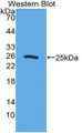 Western Blot; Sample: Recombinant protein.