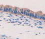 Syncoilin (Sync) Polyclonal Antibody, Cat#CAU22364