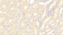 DAB staining on IHC-P; Samples: Human Kidney Tissue; Primary Ab: 20μg/ml Rabbit Anti-Human SFRP1 Antibody Second Ab: 2µg/mL HRP-Linked Caprine Anti-Rabbit IgG Polyclonal Antibody