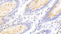 DAB staining on IHC-P; Samples: Human Colon Tissue; Primary Ab: 20μg/ml Rabbit Anti-Human SCG3 Antibody Second Ab: 2µg/mL HRP-Linked Caprine Anti-Rabbit IgG Polyclonal Antibody