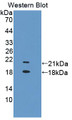 Western Blot; Sample: Recombinant protein.