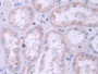 DAB staining on IHC-P; Samples: Human Kidney Tissue)