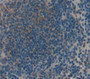 Transient Receptor Potential Cation Channel Subfamily V, Member 2 (Trpv2) Polyclonal Antibody, Cat#CAU22386