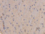 DAB staining on IHC-P; Samples: Rat Brain Tissue)