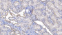 DAB staining on IHC-P; Samples: Human Kidney Tissue;  Primary Ab: 20µg/ml   Rabbit Anti-Human PRDX5 Antibody Second Ab: 2µg/mL HRP-Linked Caprine Anti-Rabbit IgG Polyclonal Antibody 