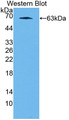 Western Blot; Sample: Recombinant protein.