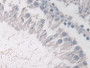 DAB staining on IHC-P; Samples: Rat Testis Tissue;  Primary Ab: 10µg/ml Rabbit Anti-Rat PDE4B Antibo