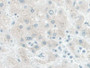 DAB staining on IHC-P; Samples: Human Liver Tissue)