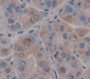 Microfibrillar Associated Protein 5 (Mfap5) Polyclonal Antibody, Cat#CAU22441