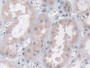 DAB staining on IHC-P; Samples: Human Kidney Tissue; Primary Ab: 10µg/ml Rabbit Anti-Human VAPB Antibody Second Ab: 2µg/mL HRP-Linked Caprine Anti-Rabbit IgG Polyclonal Antibody