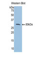 Western Blot; Sample: Recombinant protein.