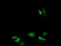 DAB staining on fromalin fixed paraffin-embedded Stomach tissue)