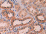 DAB staining on IHC-P; Samples: Human Kidney Tissue; Primary Ab: 30µg/ml Rabbit Anti-Human LOXL4 Antibody Second Ab: 2µg/mL HRP-Linked Caprine Anti-Rabbit IgG Polyclonal Antibody