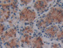 DAB staining on IHC-P; Samples: Human Stomach Tissue; Primary Ab: 10µg/ml Rabbit Anti-Human LOXL4 Antibody Second Ab: 2µg/mL HRP-Linked Caprine Anti-Rabbit IgG Polyclonal Antibody