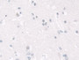 DAB staining on IHC-P; Samples: Human Cerebrum Tissue;  Primary Ab: 30µg/ml Rabbit Anti-Human LMNB1