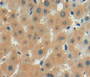 DAB staining on fromalin fixed paraffin-embedded liver tissue)