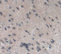 Used in DAB staining on fromalin fixed paraffin- embedded Kidney tissue