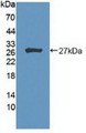 Western Blot; Sample: Recombinant HIPK2, Human.