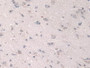 DAB staining on IHC-P; Samples: Human Brain Tissue.