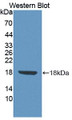 Western Blot; Sample: Recombinant protein.