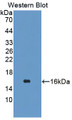 Western Blot; Sample: Recombinant protein.