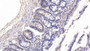 DAB staining on IHC-P; Samples: Rat Small intestine Tissue; Primary Ab: 20µg/ml Rabbit Anti-Rat FBLN3 Antibody Second Ab: 2µg/mL HRP-Linked Caprine Anti-Rabbit IgG Polyclonal Antibody