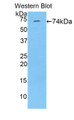 Western Blot; Sample: Recombinant protein.