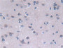 DAB staining on IHC-P; Samples: Human Cerebrum Tissue; Primary Ab: 30µg/ml Rabbit Anti-Human FADS2 Antibody Second Ab: 2µg/mL HRP-Linked Caprine Anti-Rabbit IgG Polyclonal Antibody