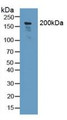 Western Blot; Sample: Human Lung Tissue.