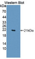 Western Blot; Sample: Recombinant protein.