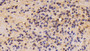 DAB staining on IHC-P; Samples: Mouse Cerebrum Tissue; Primary Ab: 10μg/ml Rabbit Anti-Mouse SPON1 Antibody Second Ab: 2µg/mL HRP-Linked Caprine Anti-Rabbit IgG Polyclonal Antibody