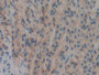 DAB staining on IHC-P; Samples: Rat Stomach Tissue; Primary Ab: 10µg/ml Rabbit Anti-Rat DOK7 Antibody Second Ab: 2µg/mL HRP-Linked Caprine Anti-Rabbit IgG Polyclonal Antibody