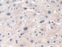 DAB staining on IHC-P; Samples: Human Liver Tissue; Primary Ab: 10µg/ml Rabbit Anti-Human DOK3 Antibody Second Ab: 2µg/mL HRP-Linked Caprine Anti-Rabbit IgG Polyclonal Antibody