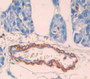 Carnitine Palmitoyltransferase 1B, Muscle (Cpt1B) Polyclonal Antibody, Cat#CAU22523