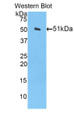 Western Blot; Sample: Recombinant protein.