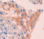 Used in DAB staining on fromalin fixed paraffin- embedded liver tissue