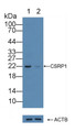Knockout Varification: ; Lane 1: Wild-type Hela cell lysate; ; Lane 2: CSRP1 knockout Hela cell lysate; ; Predicted MW: 21kd ; Observed MW: 22kd; Primary Ab: 1µg/ml Rabbit Anti-Human CSRP1 Antibody; Second Ab: 0.2µg/mL HRP-Linked Caprine Anti-Rabbit IgG Polyclonal Antibody;
