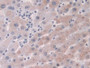 DAB staining on IHC-P; Samples: Human Liver Tissue; Primary Ab: 10µg/ml Rabbit Anti-Human CRABP2 Antibody Second Ab: 2µg/mL HRP-Linked Caprine Anti-Rabbit IgG Polyclonal Antibody