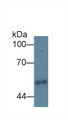 Western Blot; Sample: Human Urine; ; Primary Ab: 3µg/ml Rabbit Anti-Human CPE Antibody; Second Ab: 0.2µg/mL HRP-Linked Caprine Anti-Rabbit IgG Polyclonal Antibody;