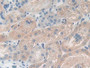 DAB staining on IHC-P; Samples: Mouse Kidney Tissue)
